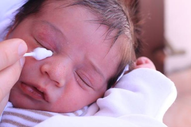 Ilustrasi penyebab mata bayi belekan (Sumber: Pexels)