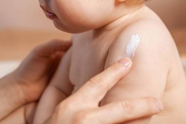 Ilustrasi lotion anti nyamuk untuk bayi (Sumber: Pexels)