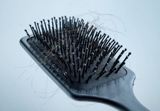 Rambut rontok pada perempuan berhijab (Sumber: https://www.shutterstock.com/image-photo/black-comb-lots-hair-loss-isolated-1745118173)
