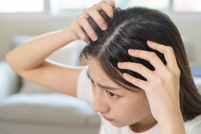 Ilustrasi kulit kepala perempuan bermasalah. Foto: Kmpzzz/Shutterstock