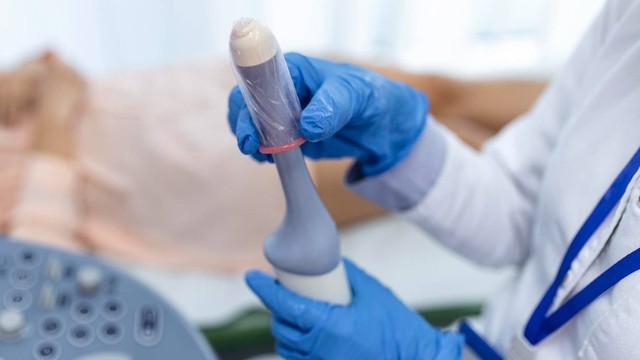 Mengenal USG Transvaginal, USG lewat Vagina