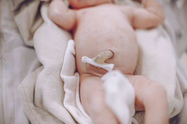 Ilustrasi kenapa pusar bayi menonjol keluar. Foto Pexels 