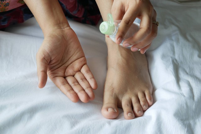 Ilustrasi mengoleskan keratolitik pada kulit kaki. Foto: Unsplash