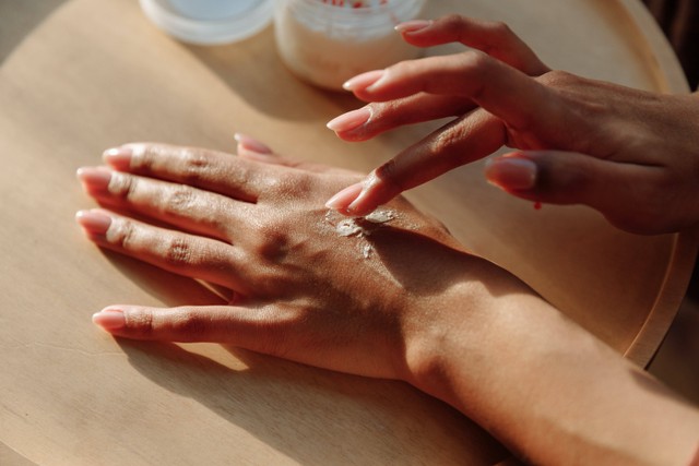 Ilustrasi mengatasi gatal berair di kulit dengan obat topikal. Foto: Pexels