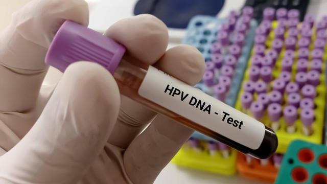 Ilustrasi HPV DNA. Foto: Innovative Creation/Shutterstock