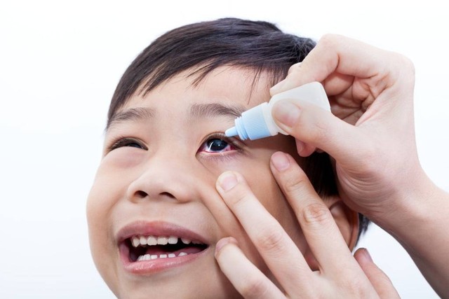 Ilustrasi penggunaan obat tetes mata anak. Foto: Shutterstock.com