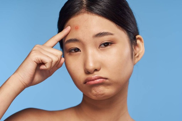 Ilustrasi seorang wanita dengan masalah kulit wajah. Foto: Shutterstock.com