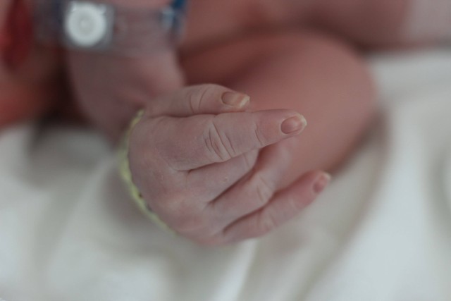  Ilustrasi acrocyanosis pada bayi. Foto: Shutterstock