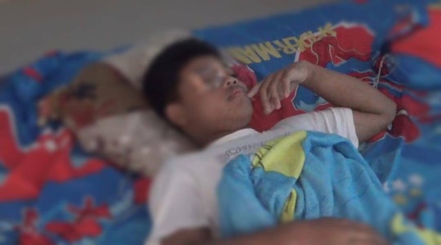 Korban pengeroyokan Dio Dwi (14) terbaring lemas, mata kanannya terpaksa dipasang pelindung akibat mengalami luka dan harus dioperasi. | Foto : Ist