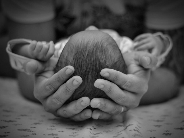 Gangguan pada perkembangan bayi juga bisa menjadi salah satu penyebab ubun-ubun bayi cekung ke dalam. Foto: Pexels.com