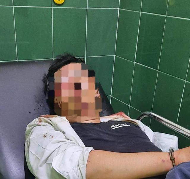 Pelaku Perampokan Bank Arta Kedaton Punya Kartu Kuning, Ini Kata Polda Lampung (1)