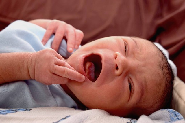 Ilustrasi bayi mengalami sariawan. Foto: Shutterstock.com