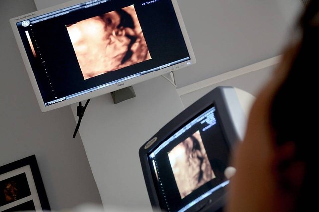Ilustrasi Cara Membaca Hasil USG. Foto: Pixabay/MedicalPrudens.