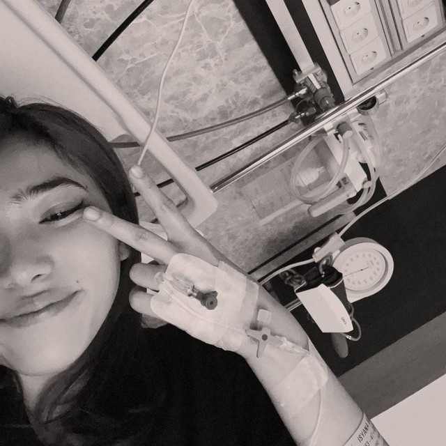 Isyana Sarasvati ungkap derita autoimun. Foto: Instagram/@isyanasarasvati