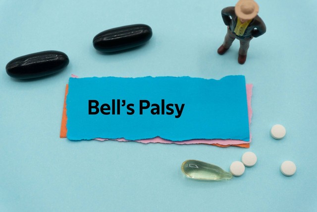 Ilustrasi bell's palsy. Foto: evan_huang/Shutterstock