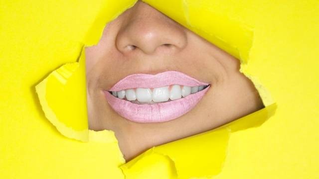 Ilustrasi cara membersihkan gigi kuning, Foto oleh Hana Lopez di Unsplash