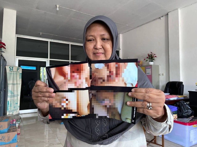 Dewi Ari Purnamawati, kuasa hukum korban, menunjukkan foto-foto kondisi alat kelamin korban usai diduga menjadi korban malapraktik klinik sunat di Pontianak. Foto: Teri/Hi!Pontianak 