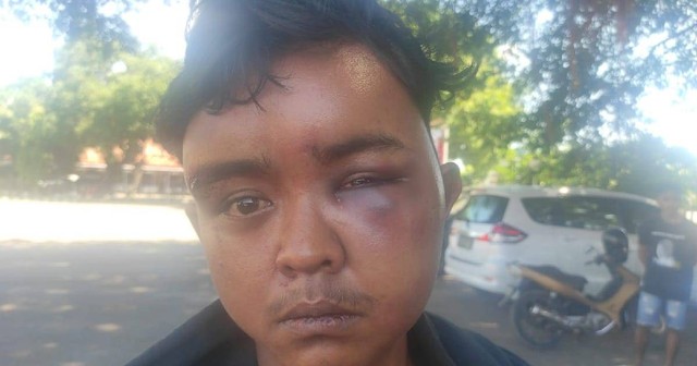 Keterangan foto: Korban penganiayaan Andreas Wiliam Sanda.