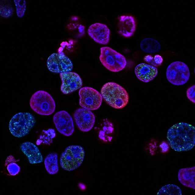 Ilustrasi Ciri-Ciri Sel. (Foto: National Cancer Institute | Unsplash.com)