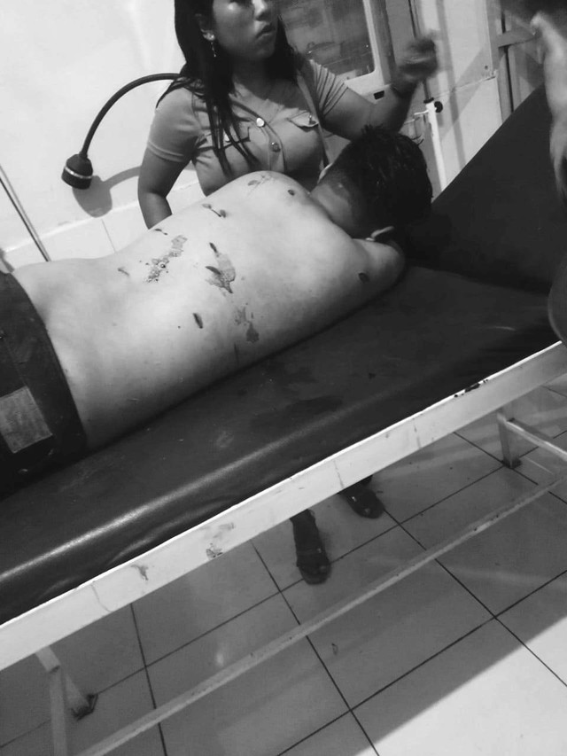 Nonton Organ Tunggal, Pria di Lampung Meninggal Akibat Luka Tusuk (1)
