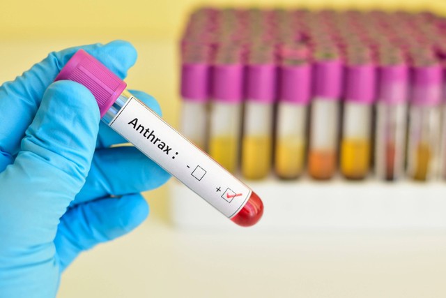 Ilustrasi sampel darah positif antraks. Foto: Jarun Ontakrai/Shutterstock