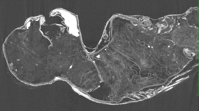 CT scan mumi putri duyung yang ditemukan di Jepang.  Foto: Kurashiki University of Science and the Arts (KUSA)