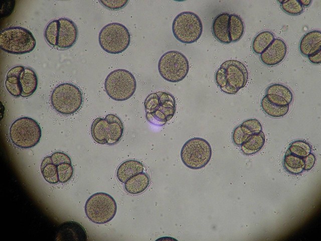Ilustrasi ciri pembelahan meiosis. Sumber: Pixabay/Belindalampcc