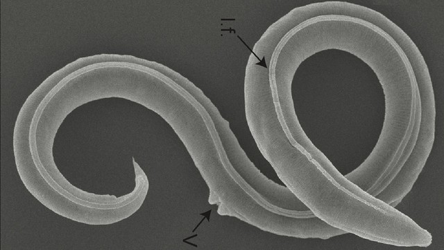 Panjang cacing yang dihidupkan kembali itu tidak kurang dari 1 milimeter. Foto: Alexei V. Tchesunov & Anastasia Shatilovich/Institute of Physicochemical and Biological Problems of Soil Science, RAS