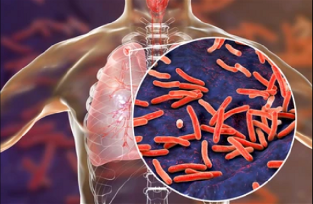 Ilustrasi Mycobacterium tuberculosis, bakteri penyebab TBC. Foto: Kateryna Kon