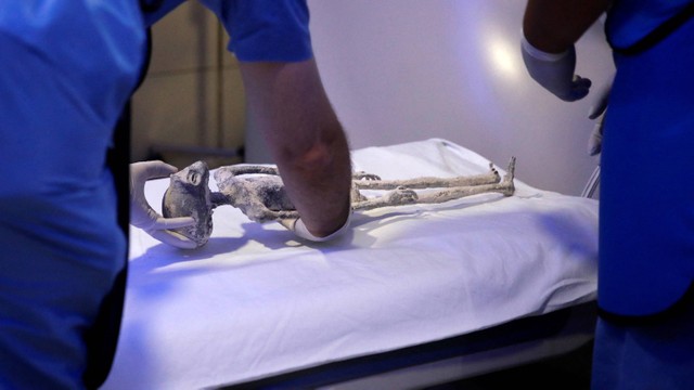 Petugas meletakan jenazah makhluk yang diduga 'bukan manusia' menjalani CT scan, di Klinik Noor, di Huixquilucan, Meksiko 18 September 2023. Foto: REUTERS/Raquel Cunha