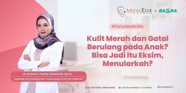 Kulit Merah dan Gatal Berulang Pada Anak Bisa Jadi Eksim, Menularkah?