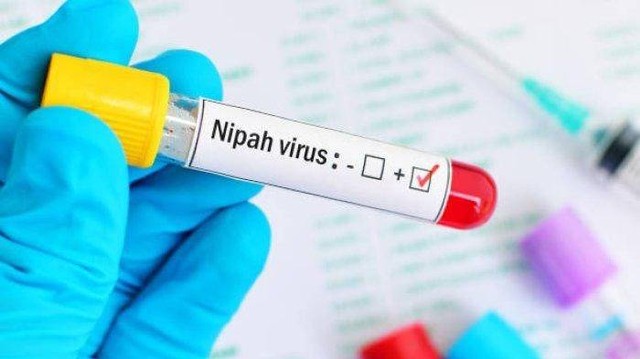 Dibanding COVID-19, Fatalitas Virus Nipah Lebih Tinggi Capai 80 Persen