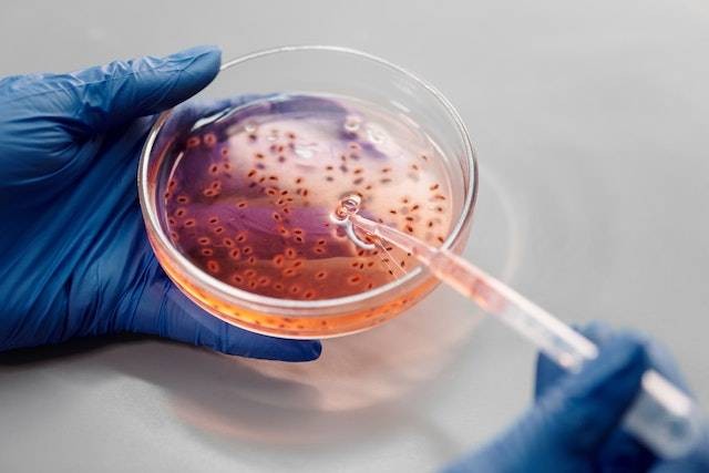 Ilustrasi bentuk-bentuk bakteri. Sumber: Pexels/Edward Jenner