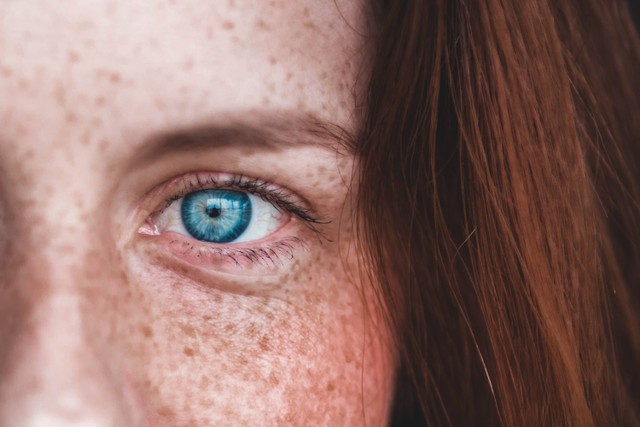 Ilustrasi Cara Mengatasi Muka Merah. Foto: Unsplash/Erik Mclean