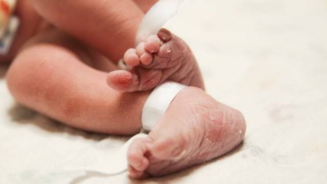 Ilustrasi kaki bayi. Foto: Shutterstock