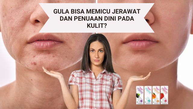 Atasi Jerawat dengan Bahan Alami Natural