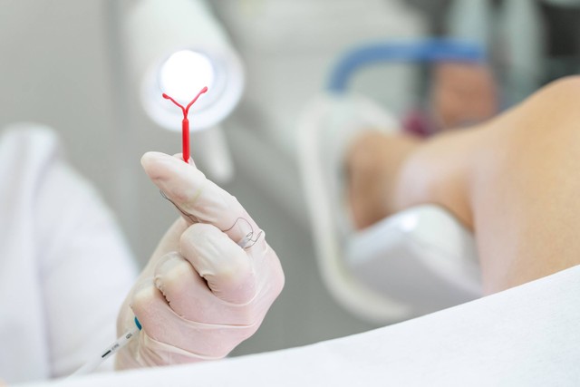 Ilustrasi dokter menjelaskan pemasangan KB IUD Foto: mariakray/Shutterstock