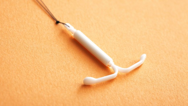 Ilustrasi KB IUD. Foto: Image Point Fr/Shutterstock