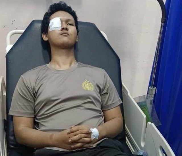 Bripda RD ditembak saat amankan pelaku pencurian sawit di Ketapang. Foto: Dok. Polda Kalbar