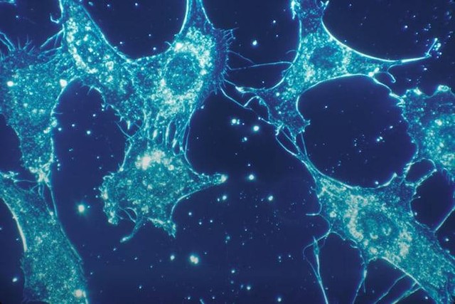 Ilustrasi contoh transpor aktif. Sumber: unsplash.com/ National Cancer Institute