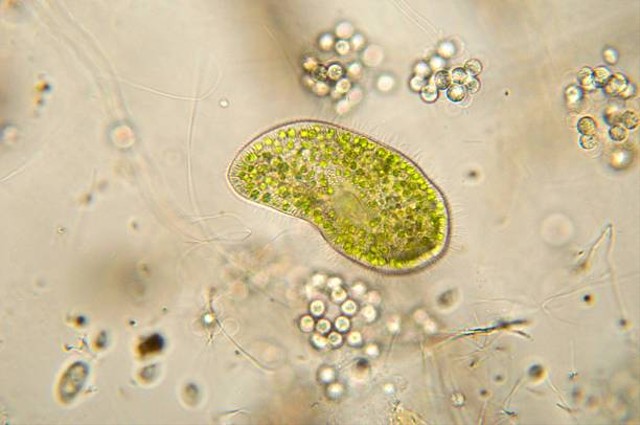 Protista Mirip Hewan Apa Saja Perbedaan Monera Dan Protista? Begini