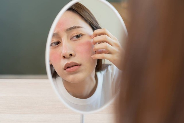 Ilustrasi kulit tidak cocok dengan skincare. Foto: Kmpzzz/Shutterstock