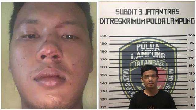 Korban penganiayaan dan pelaku penganiayaan di Bandar Lampung. | Foto: Ist, Humas Polda Lampung