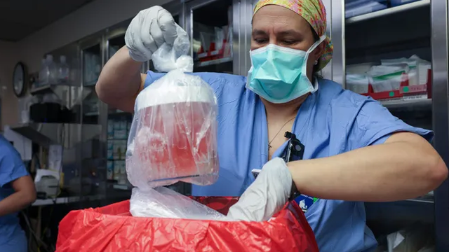 Ginjal babi yang akan ditransplantasikan ke manusia.  Foto: Massachusetts General Hospital