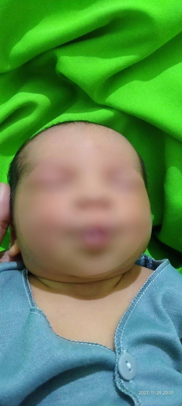 Bayi meninggal karena dipijat neneknya sejak usia dua hari. Foto: Dok. Istimewa