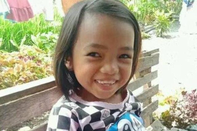 Aldelia Rahma, siswi SD korban kejahilan teman sekelas dibakar, gizi buruk lalu meninggal. Foto: Dok. Keluarga