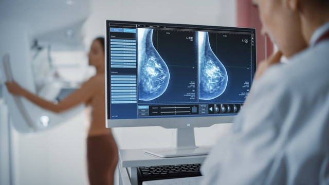 Layar Komputer di Ruang Radiologi Rumah Sakit: Wanita Berdiri Menjalani Prosedur Pemeriksaan Mammografi. Layar Menampilkan Pemindaian Mammogram Jaringan Payudara Padat (Sumber: shutterstock)