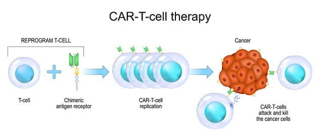 Ilustrasi Terapi Sel-T CAR. Sumber: https://www.istockphoto.com/