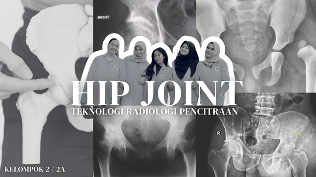 Prosedur Pemeriksaan Radiografi Hip Joint Pada Klinis Osteoarthritis ...