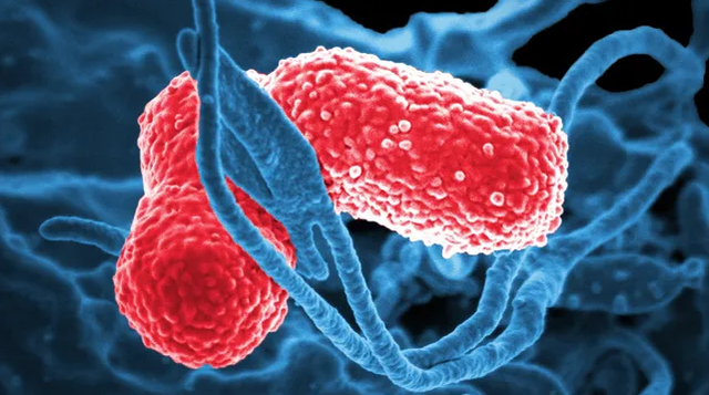 hypervirulent Klebsiella pneumoniae (hvKp).   Foto: National Institute of Allergy and Infectious Diseases